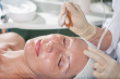 facial-peel-vancouver anti aging peels available at spaon4th, spa in vancouver