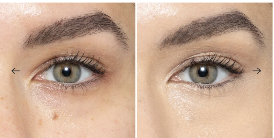 dermalogica eye density serum