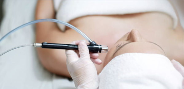 microdermabrasion special